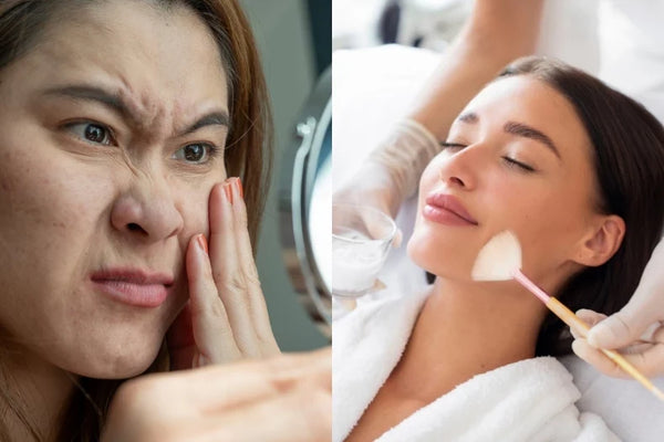 分齡抗老逆齡護膚與醫美地圖封面 Asian woman anti-aging skincare concept