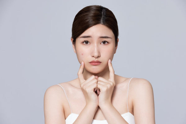 夏天快到了，轉季肌膚容易爆痘，從原因入手，教你預防同護理