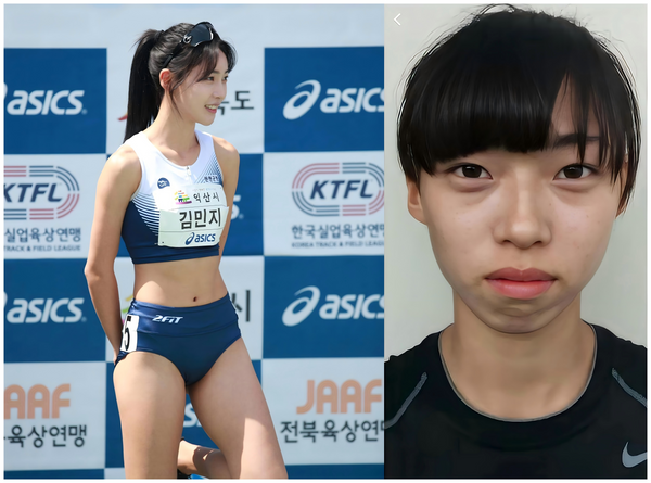 單身即地獄｜金珉志坦承打玻尿酸！牙套＋填充物變美公式｜輕醫美風險全攻略