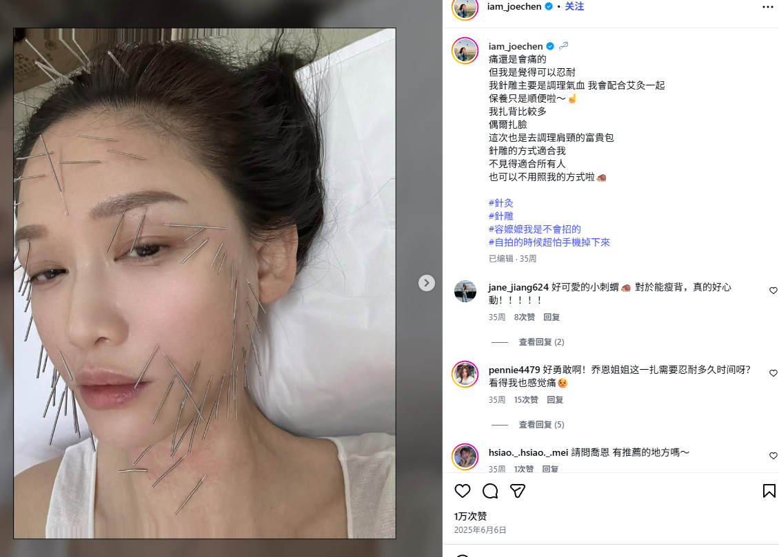 陳喬恩分享中醫美容針經驗，透過面部針灸針雕改善氣血並達至拉提抗衰老效果。