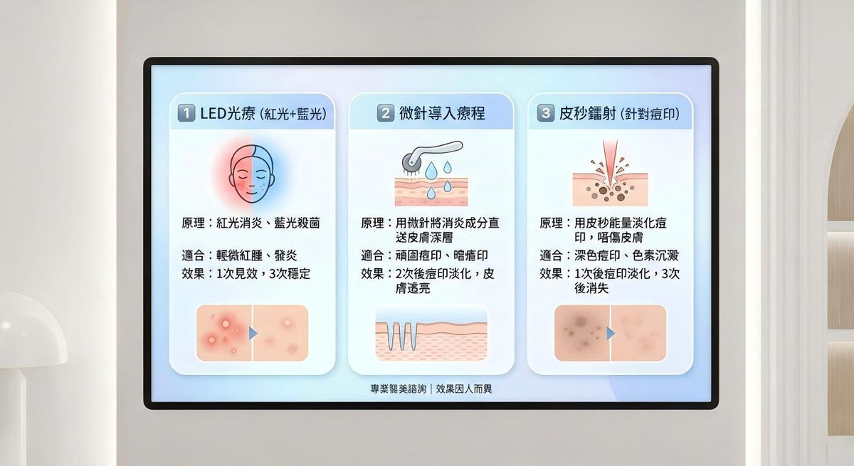 去口罩痘印療程圖解：比較LED紅藍光消炎、微針導入及皮秒鐳射淡化色素效果。